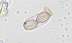Mini-Guida all''identificazione delle spore Fungine