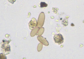 Mini-Guida all''identificazione delle spore Fungine