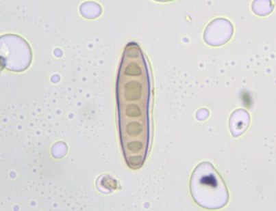 Mini-Guida all''identificazione delle spore Fungine