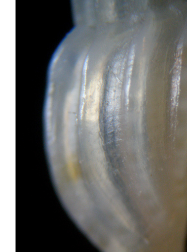 4) Mangelia multilineolata forma pusilla?