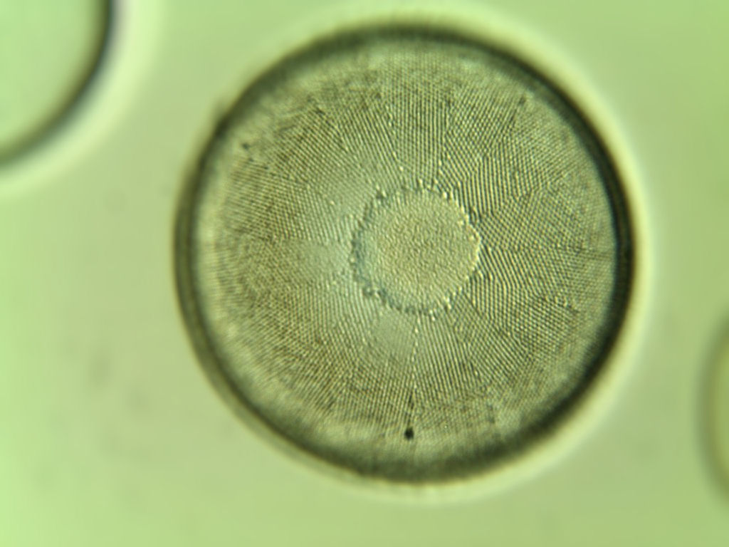 Diatomee su vetrino a 630x