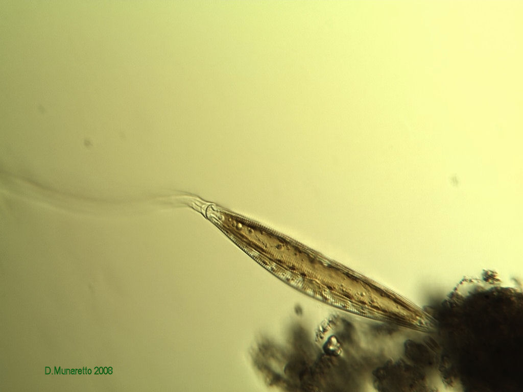 Cymbella sp. e Fragilaria sp.