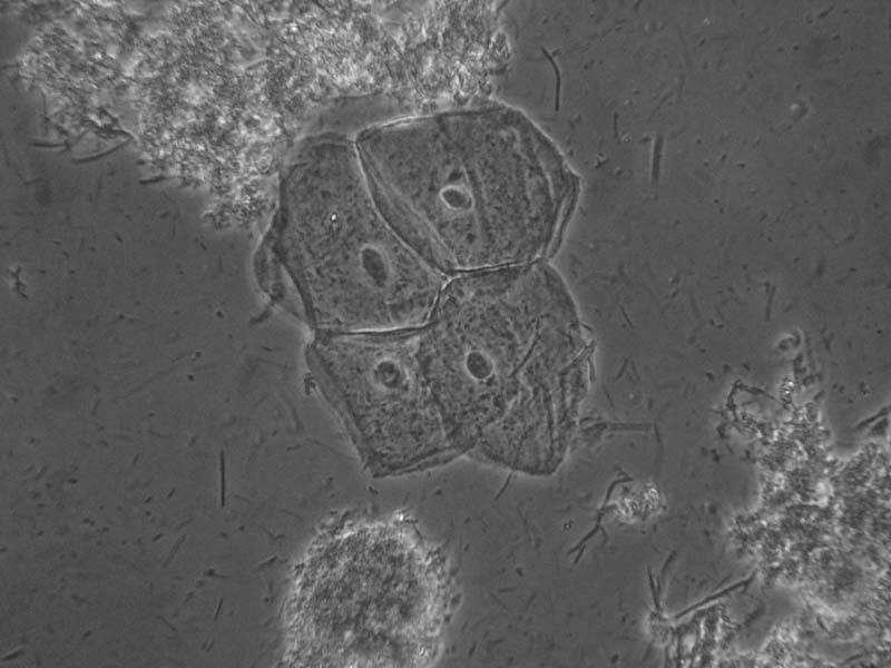MISSIONE COMPIUTA !! - MICROSCOPIO ACQUISTATO