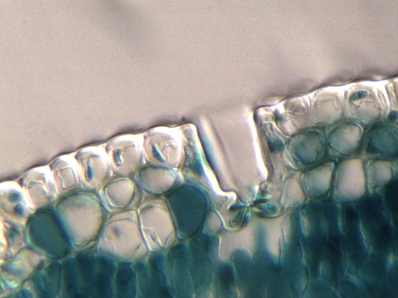 Stoma