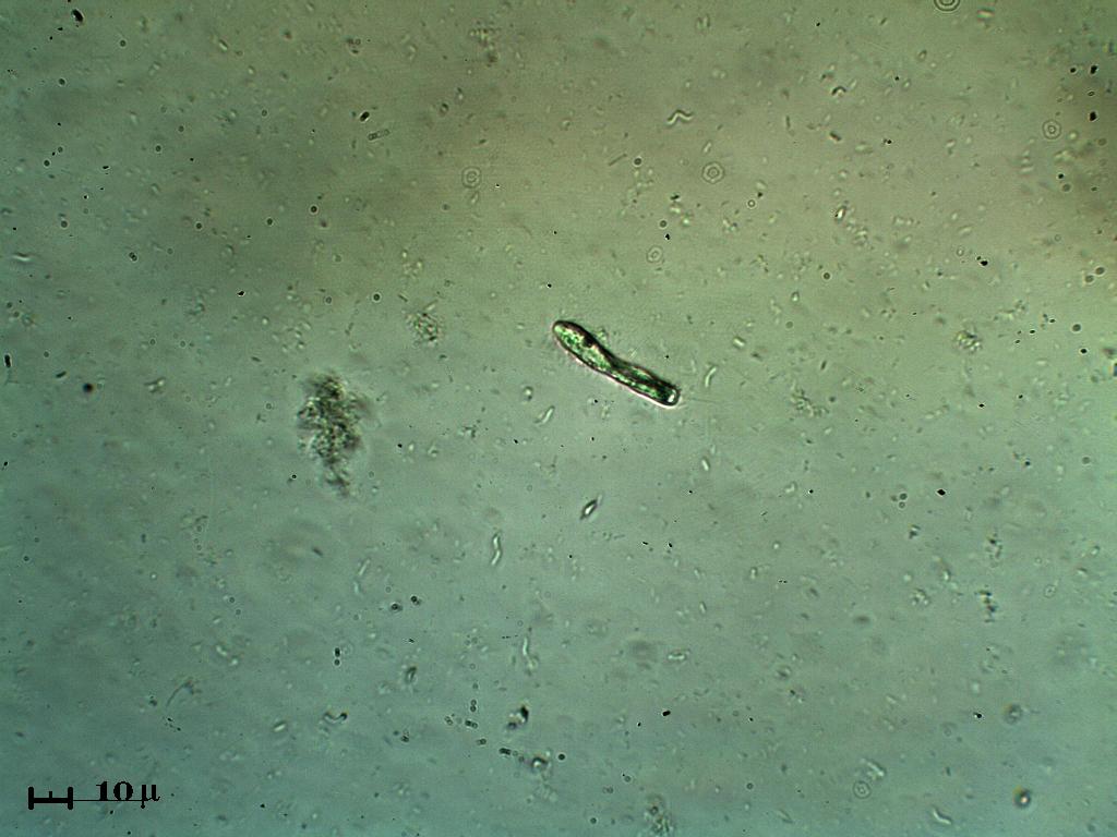 Ancora nel filtro di un acquario (Parte II)