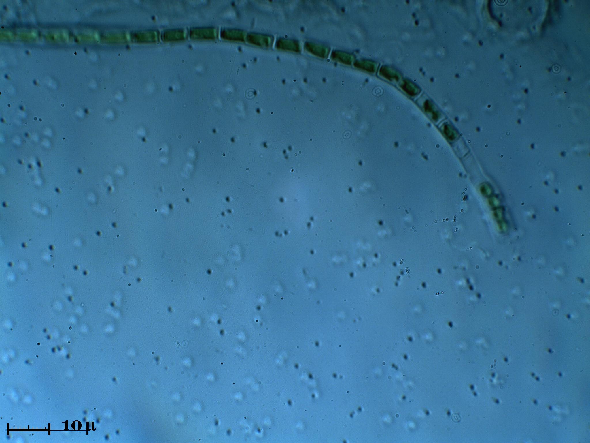 Strane microsfere