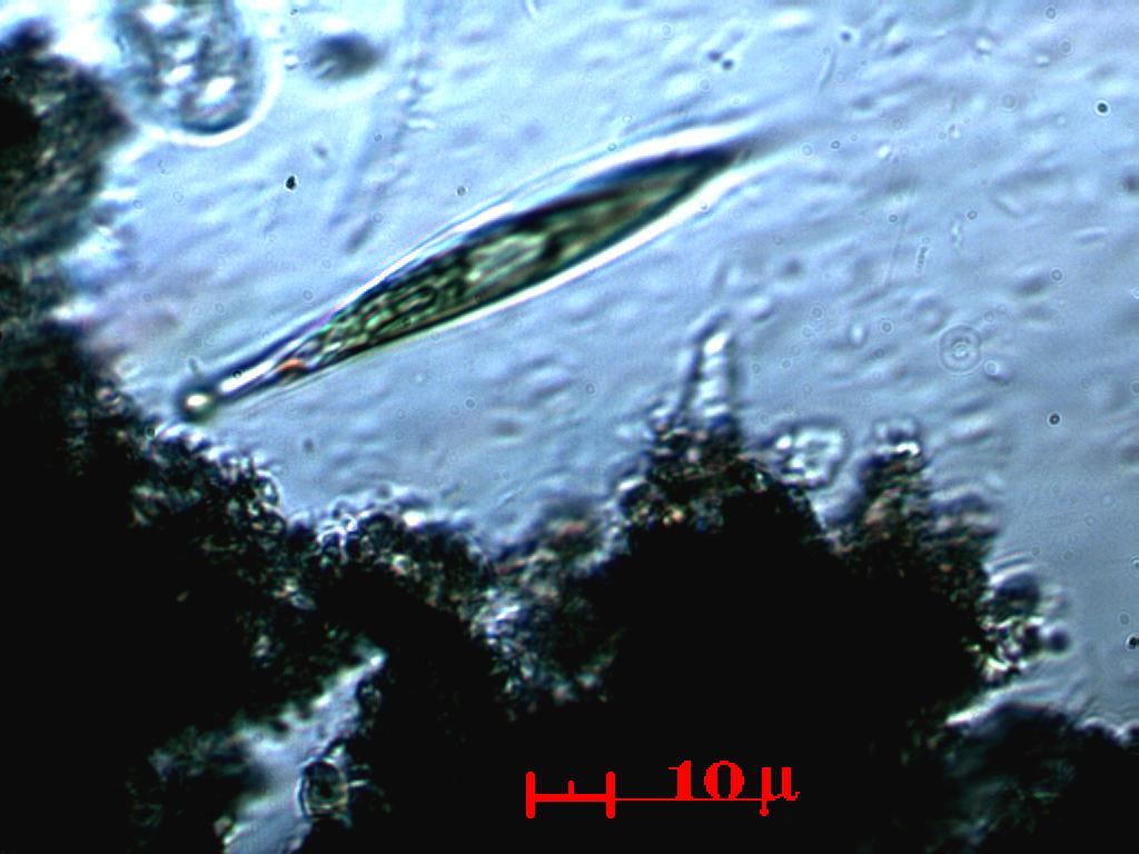 EUGLENA!  L''HO VISTA!!  E'' BELLISSIMA!!!