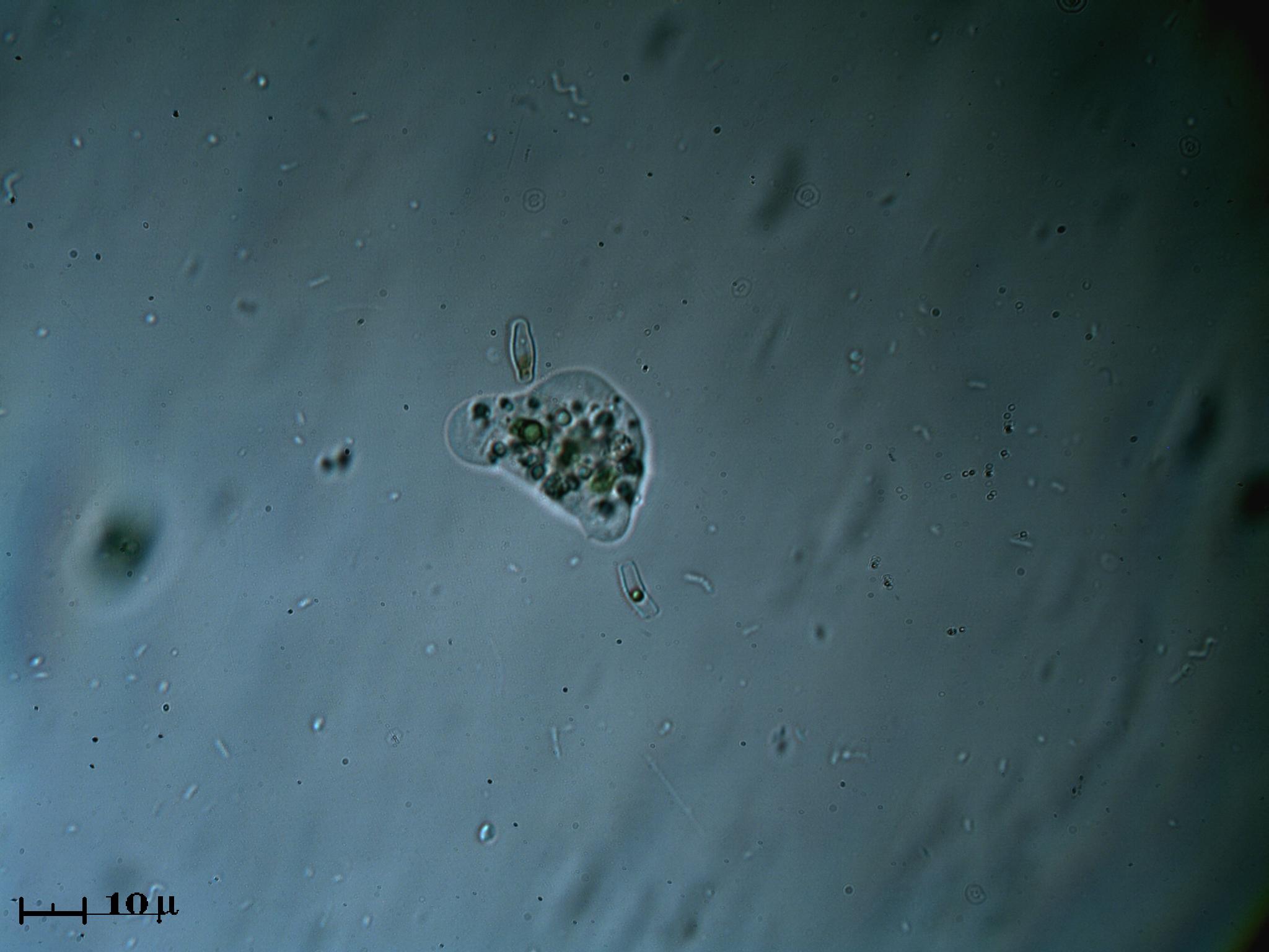 Miniamoeba e miniminidiatomea