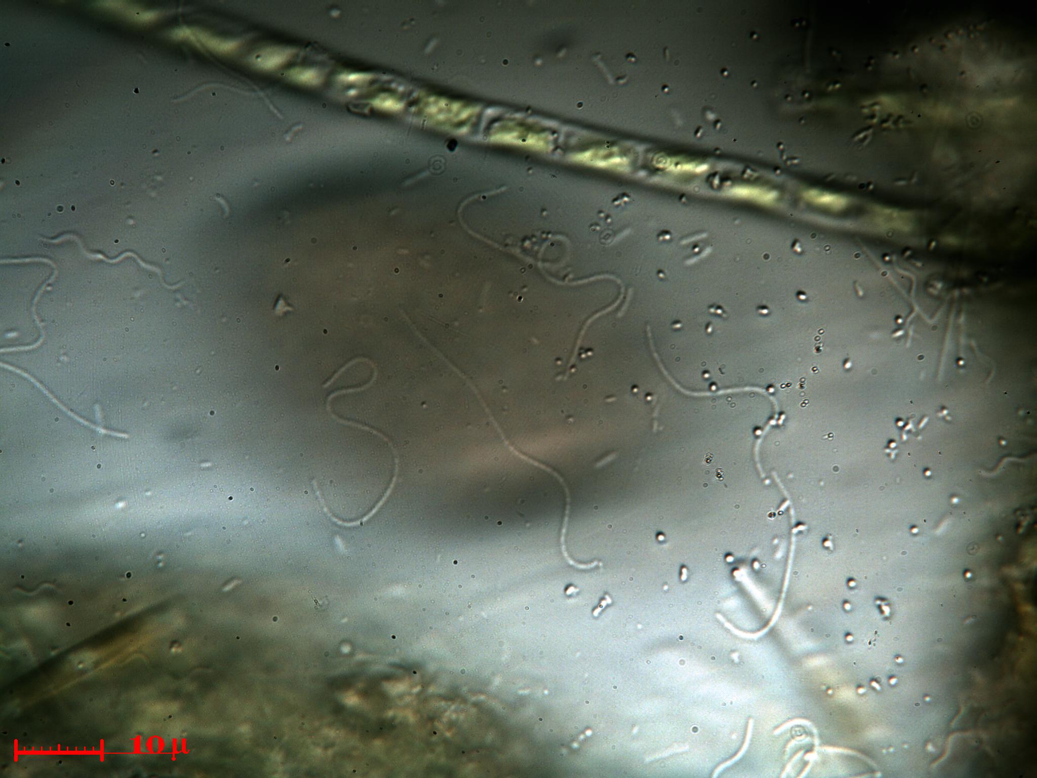 Batteri filiformi