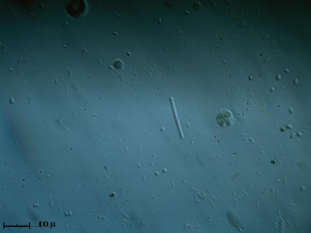 Cyanobacterio?