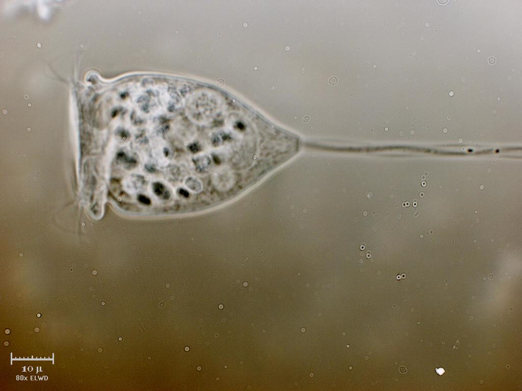 Vorticella