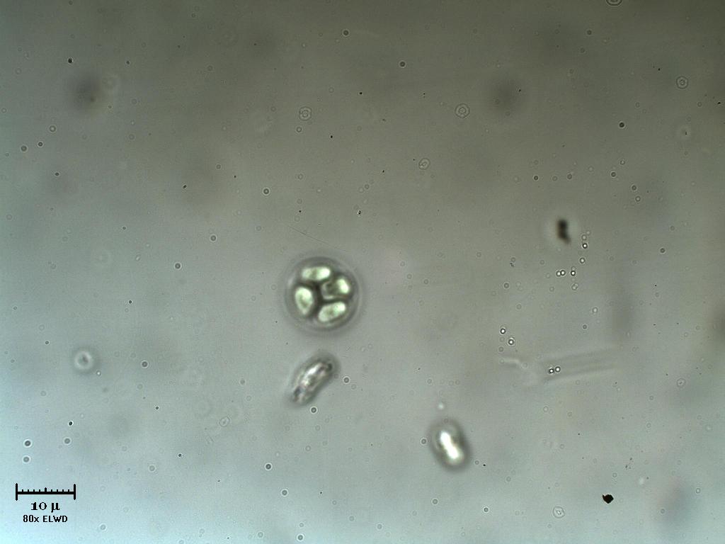 Tetrabaena o Volvulina?