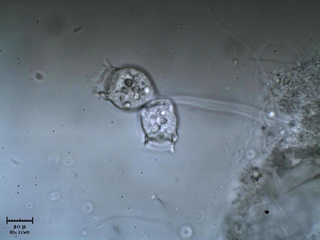 Vorticelle a Ganzirri