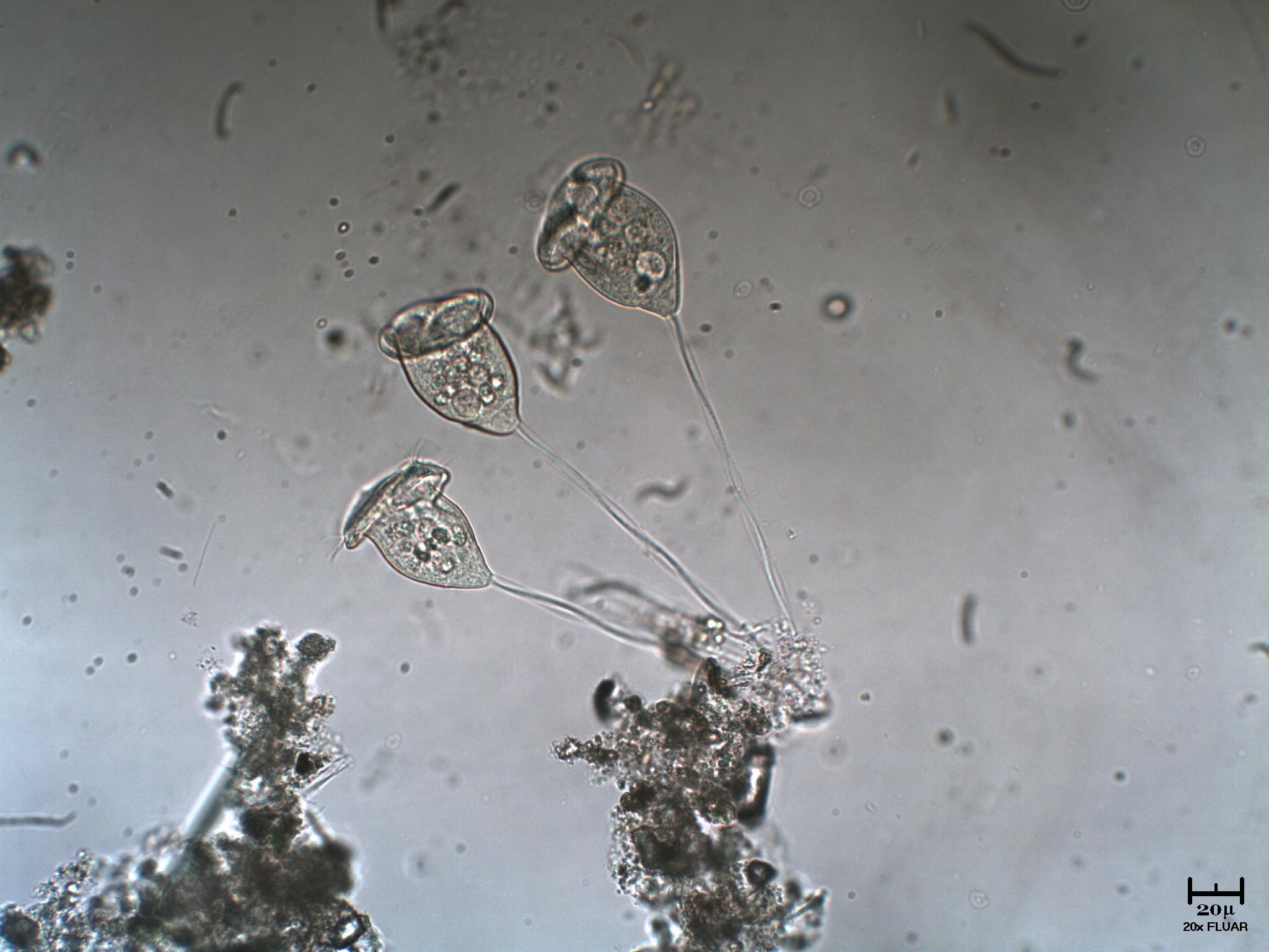 ESCOCAT - IL RITORNO  [ Vorticella sp. ]