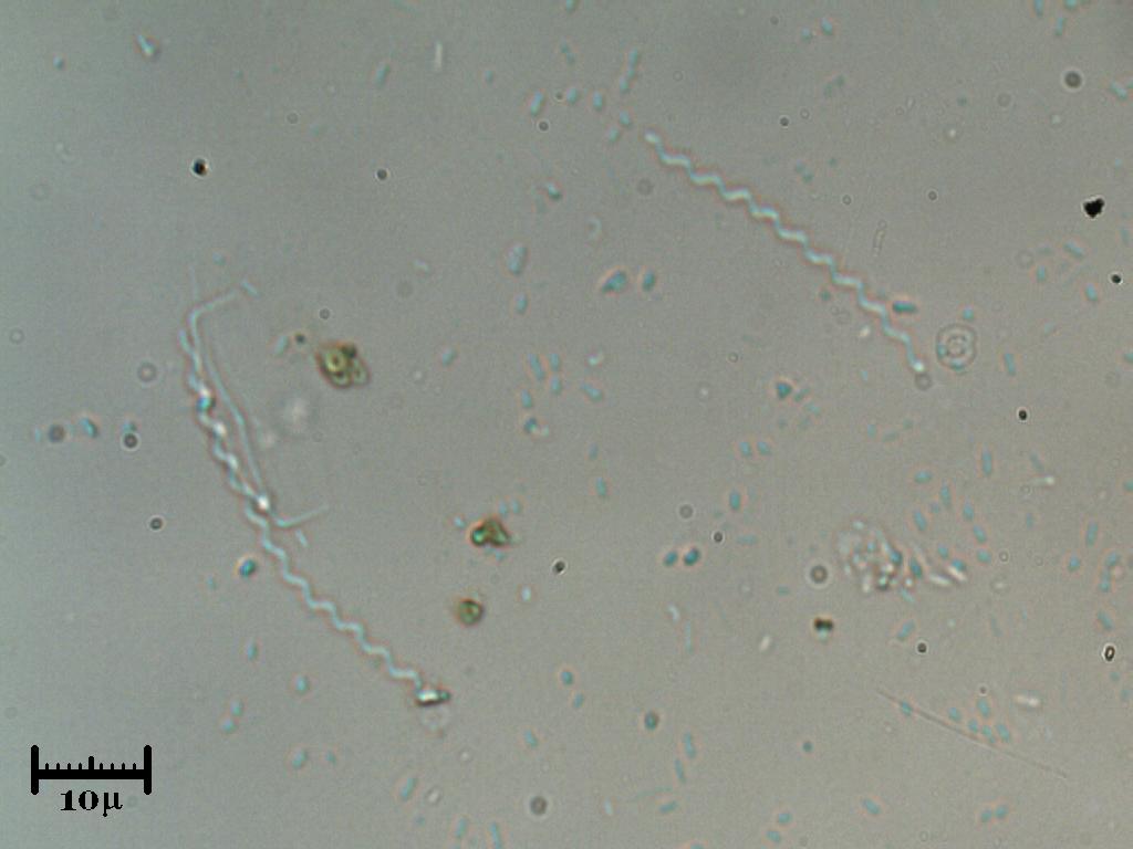 Lo show delle Spirochete