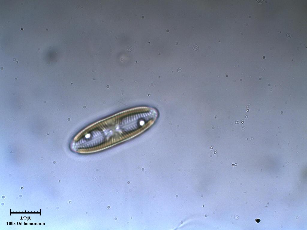 Diatoma?