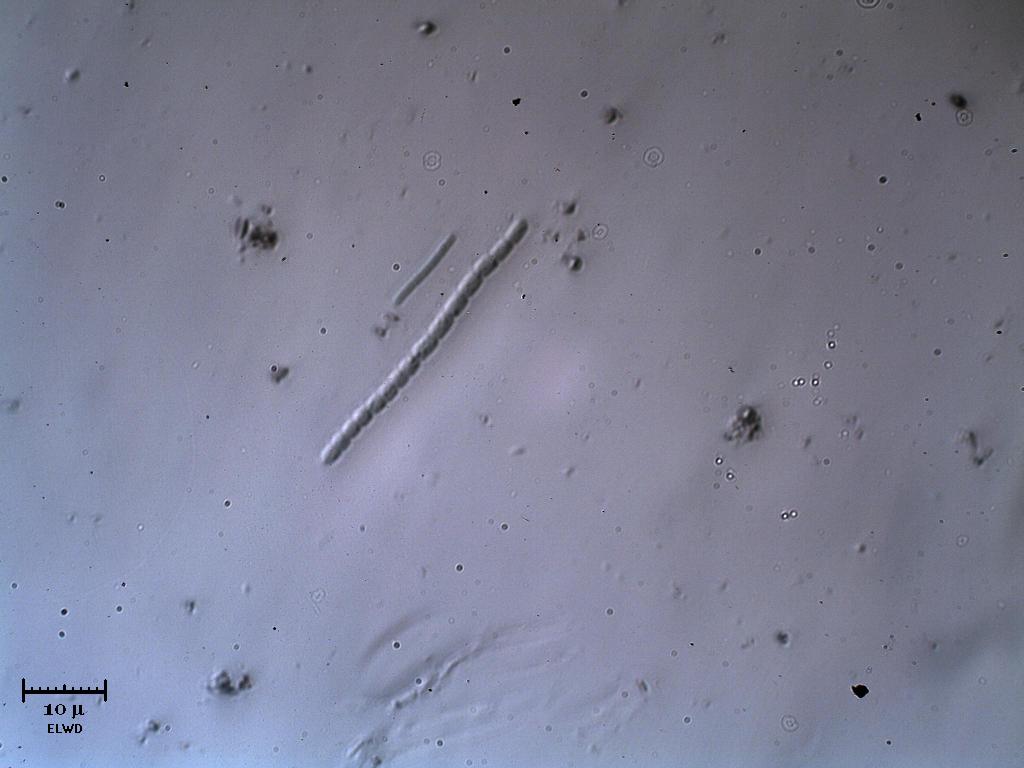 Cianobacter