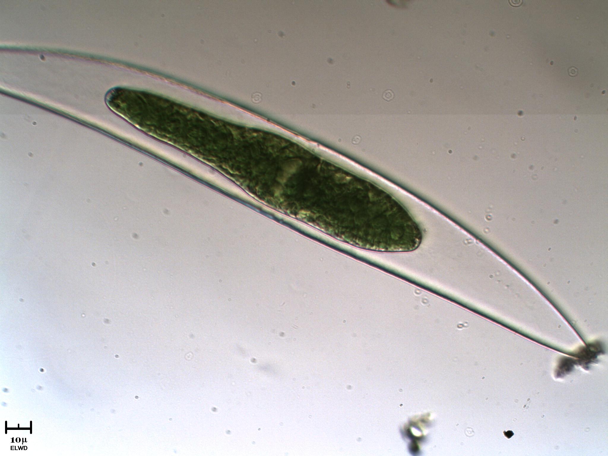 Strano Closterium