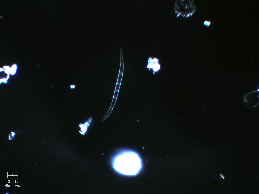 Conide o cyanoficea?