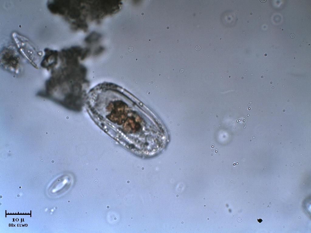 Due diatomee incapsulate?