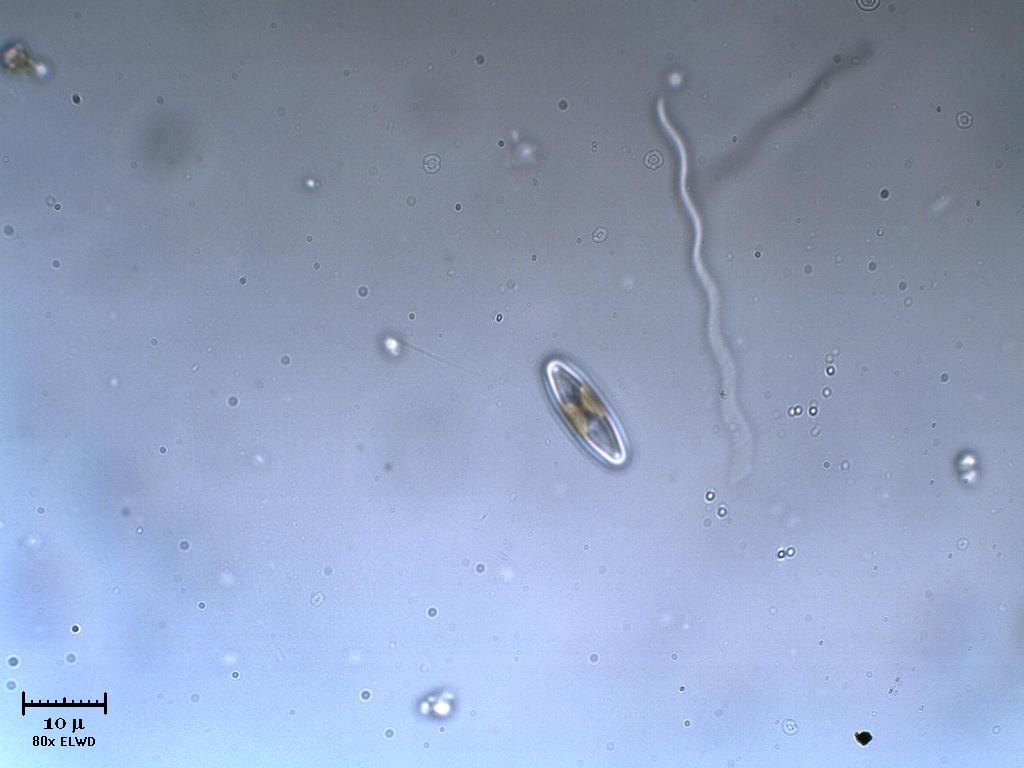 Batterio ondulatorio sfiora una diatomea sussultoria