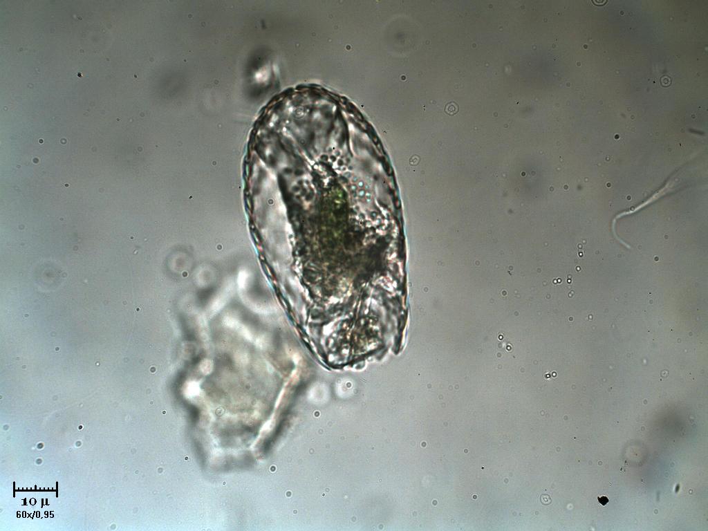 Difflugia