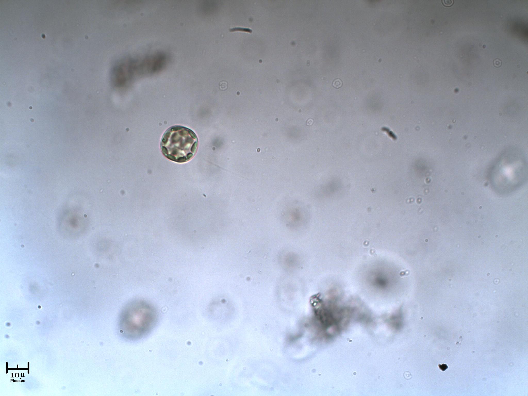 Una cyclotella?