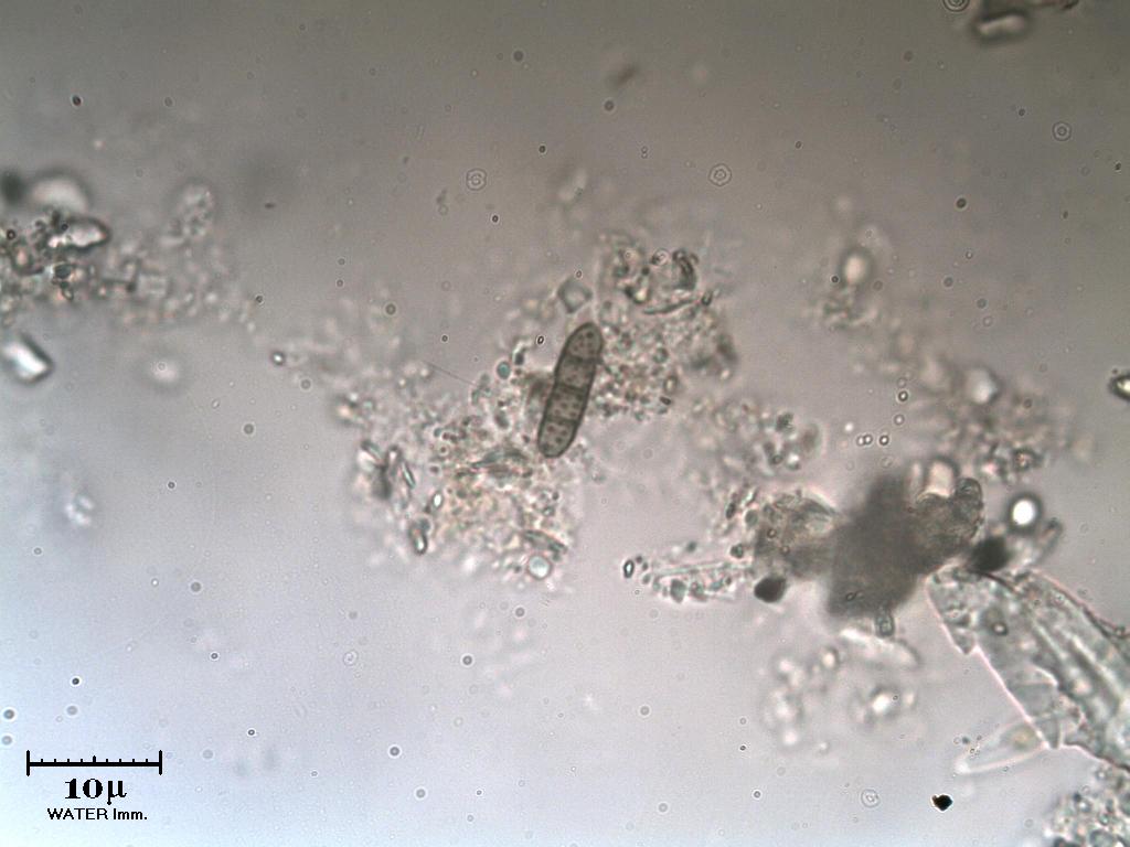 Spora water immersion