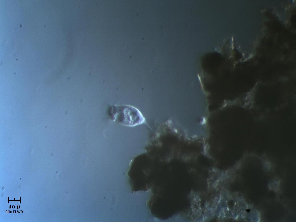 Vorticella