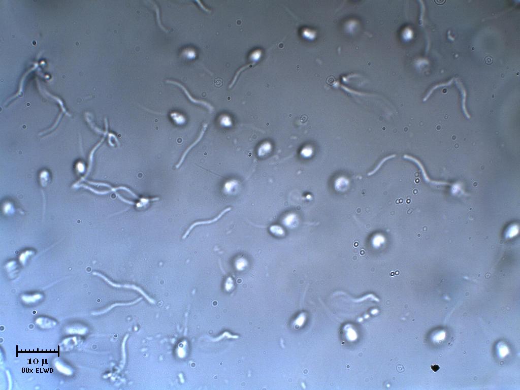 Batteri e piccoli flagellati