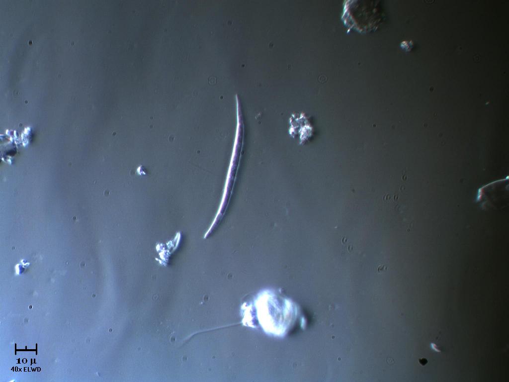Conide o cyanoficea?