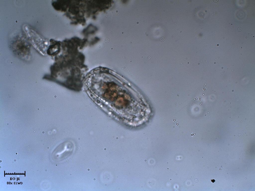 Due diatomee incapsulate?