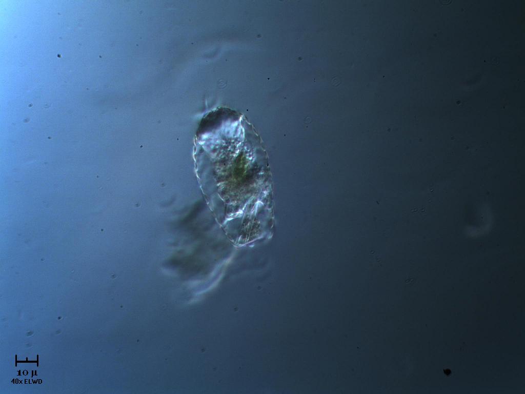 Difflugia