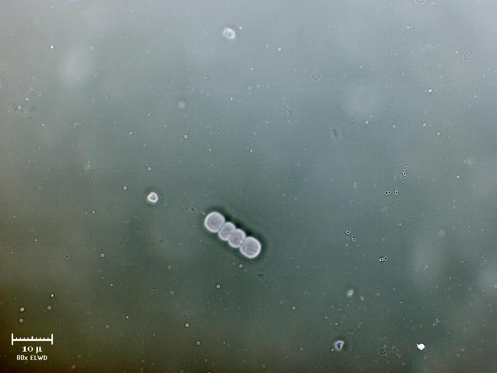 Nuovi (forse) cianobatteri