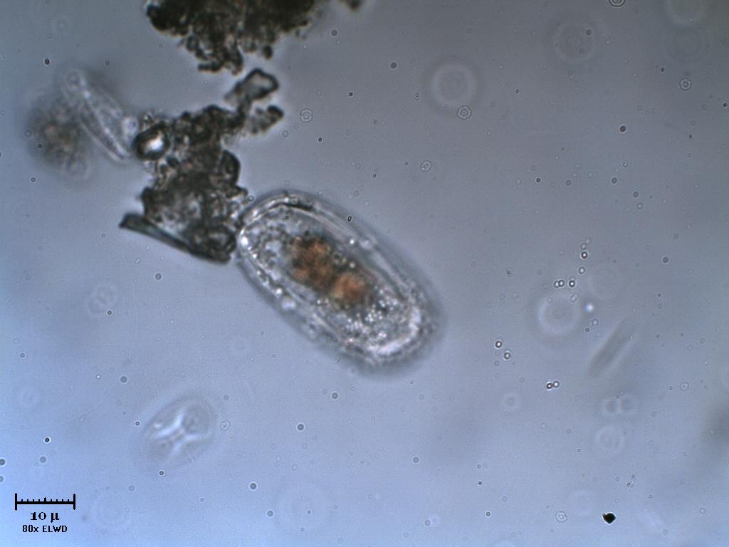 Due diatomee incapsulate?