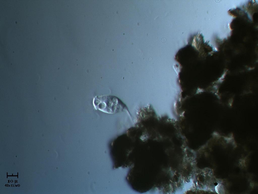 Vorticella