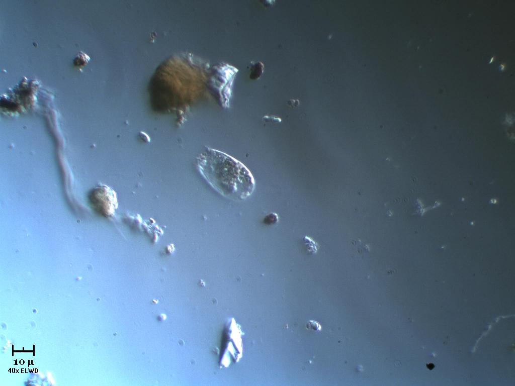 Difflugia crepuscolare