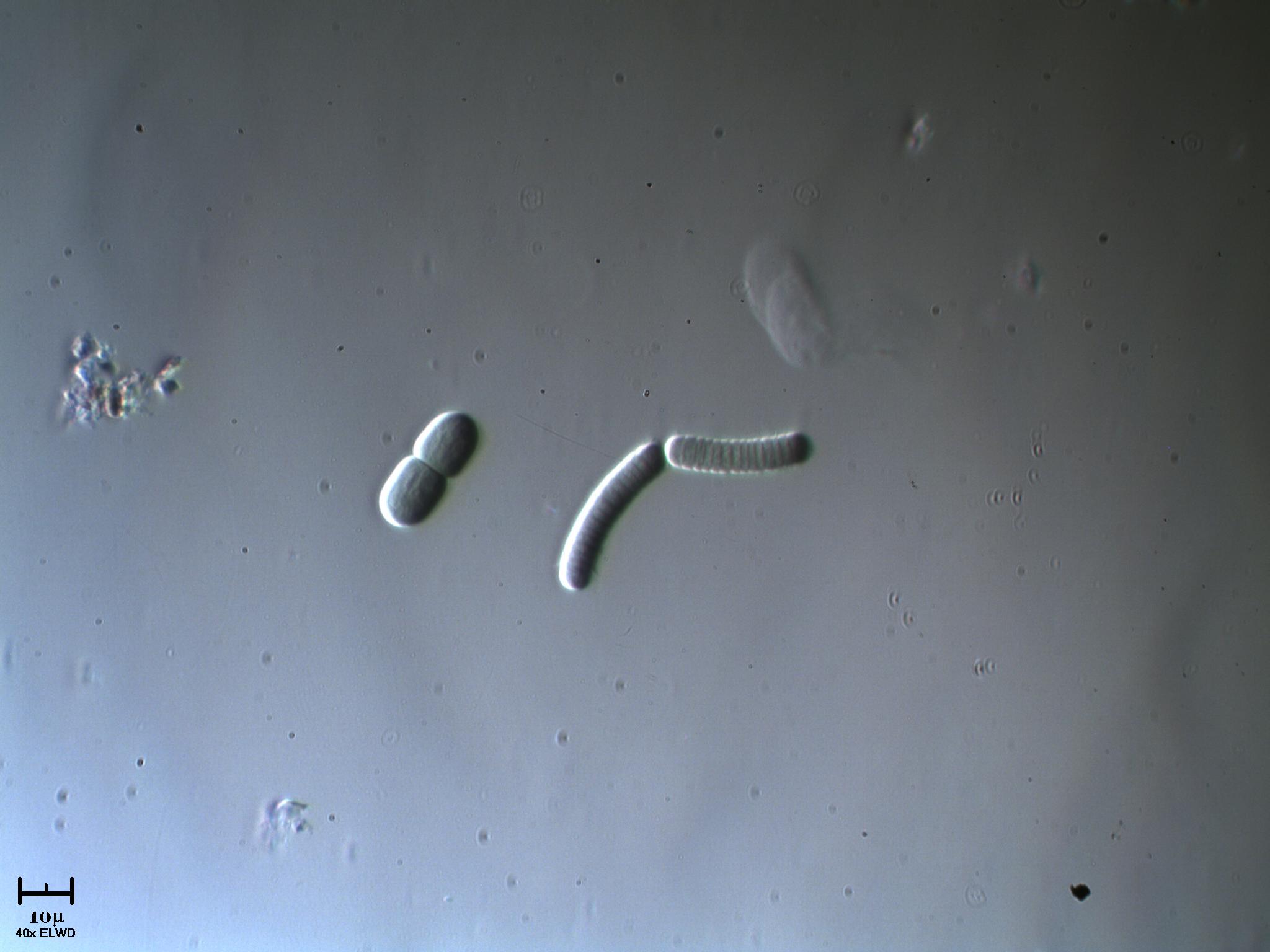 Cianobatteri