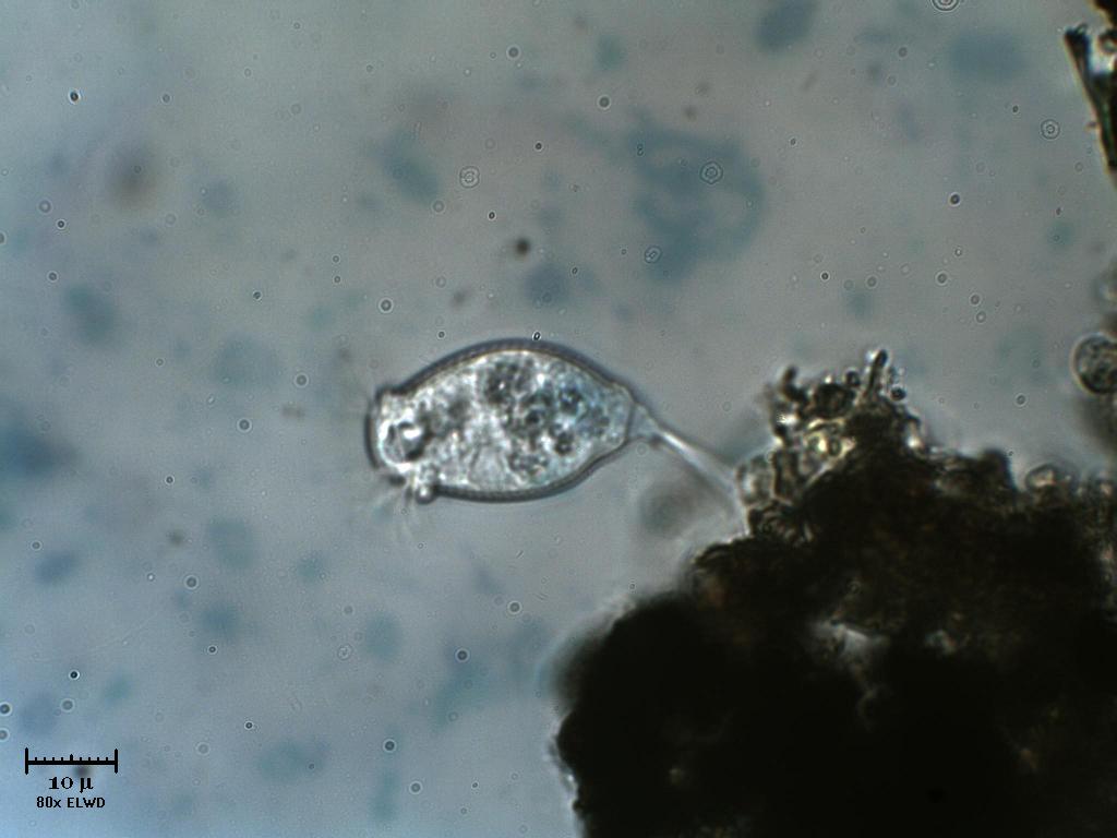 Vorticella