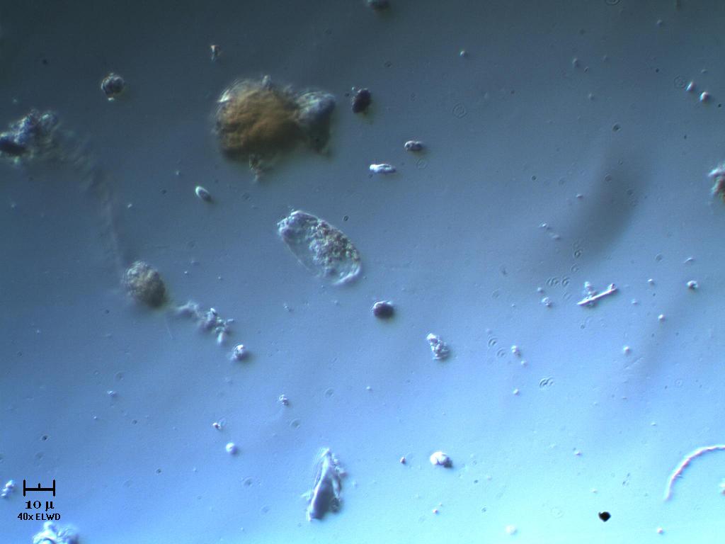 Difflugia crepuscolare