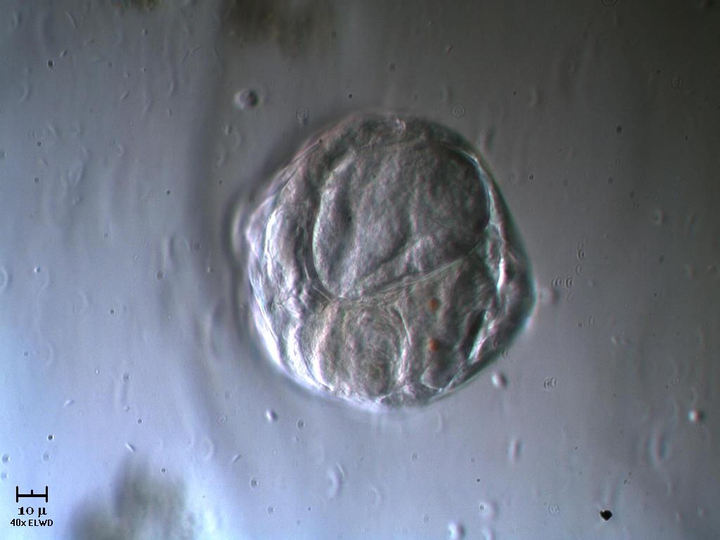 Guardate questo Rotifero