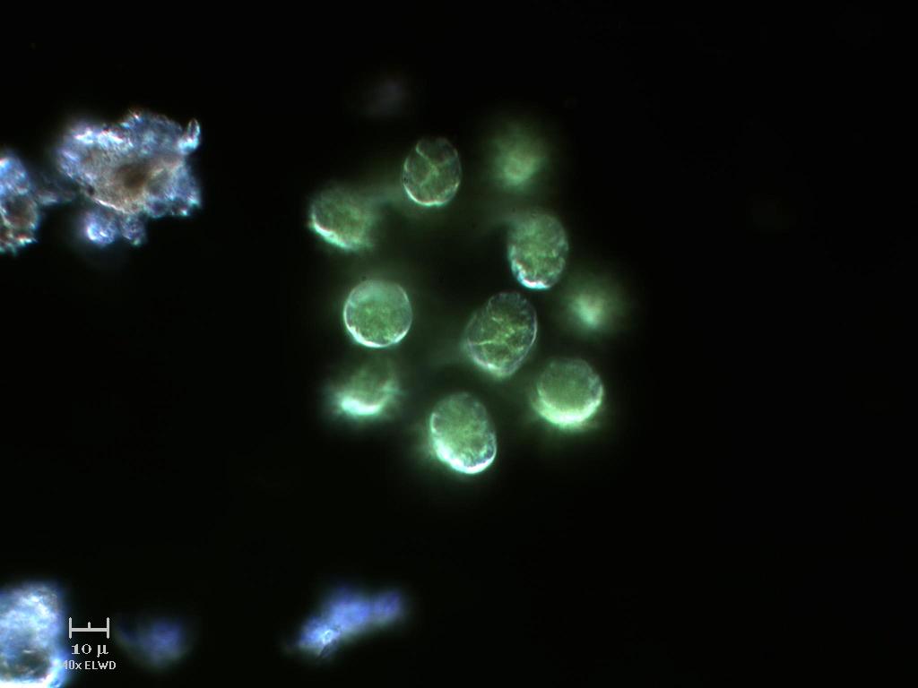 N U O V A !  Eudorina.