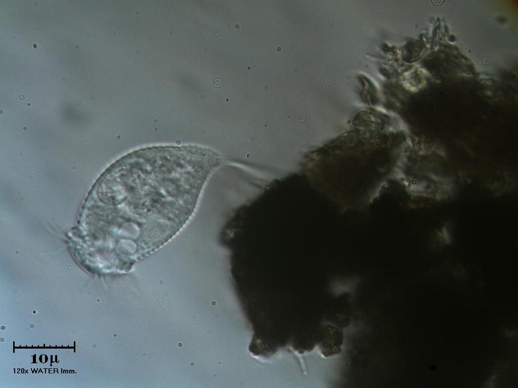 Vorticella