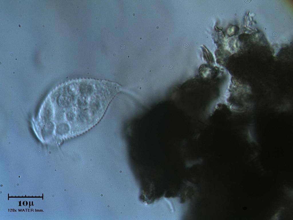 Vorticella