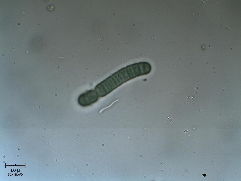 Spirillo extrafocale con Oscillatoria intrafocale