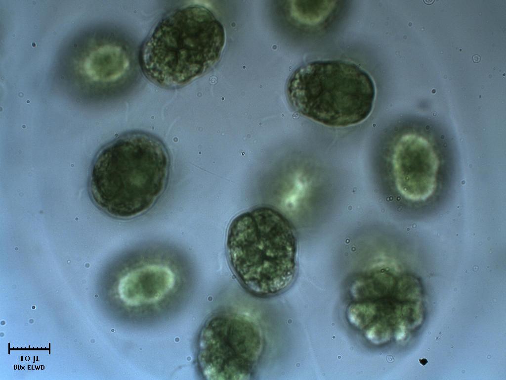 N U O V A !  Eudorina.