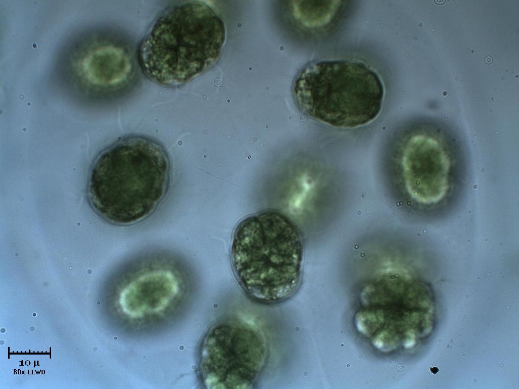 N U O V A !  Eudorina.