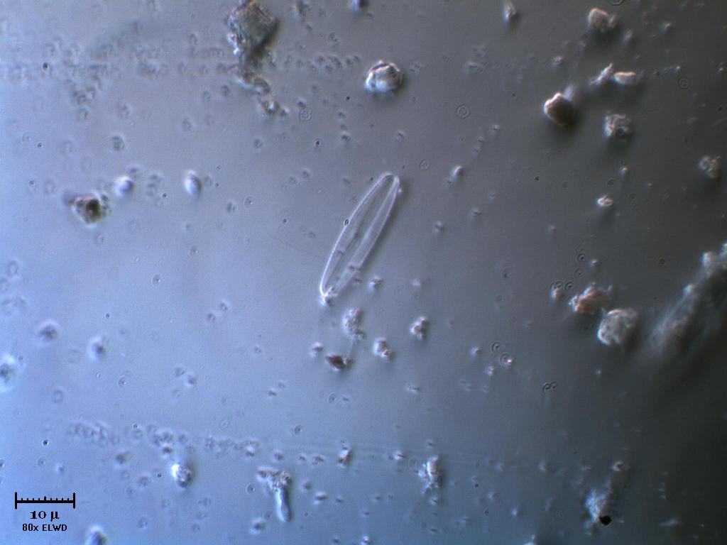 Scheletro di (fu) diatomea