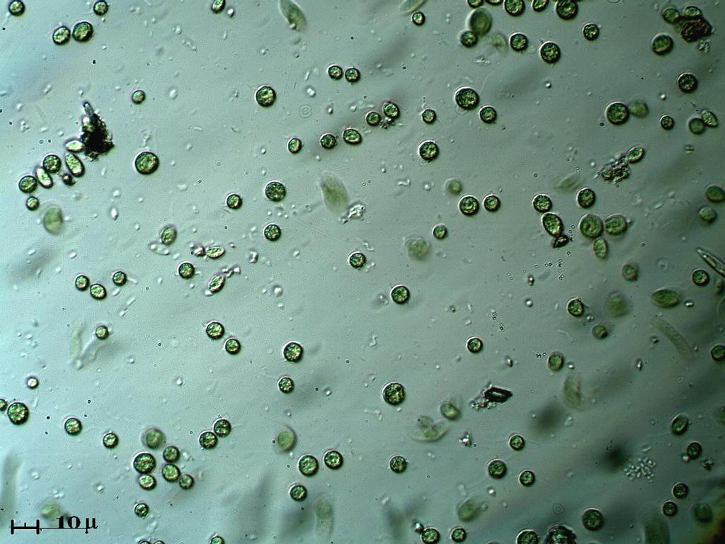 Chlorophyceae?