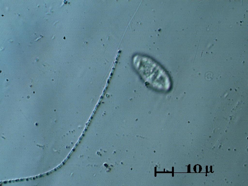 Batteriopardo + ciliato di passaggio